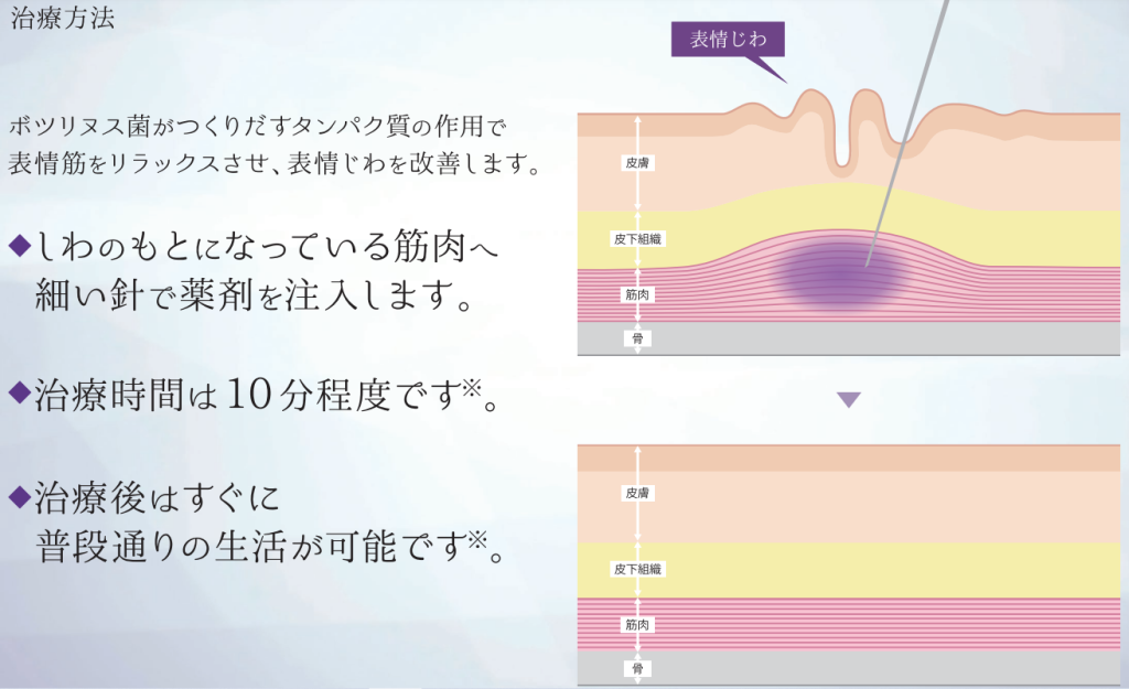 治療の方法